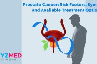 Prostate Cancer: Risk Factors, Symptoms, and Available Treatment Options