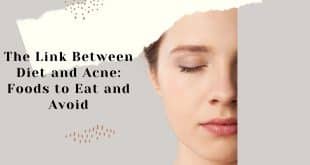 The Link Between Diet and Acne: Foods to Eat and Avoid
