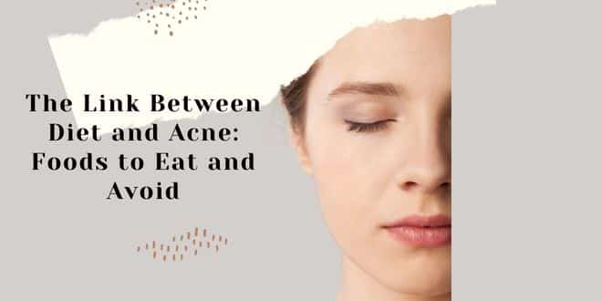 The Link Between Diet and Acne: Foods to Eat and Avoid