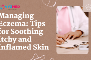 Managing Eczema: Tips for Soothing Itchy and Inflamed Skin