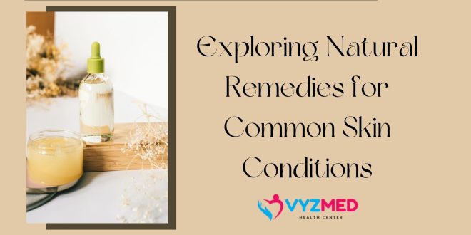 Exploring Natural Remedies for Common Skin Conditions