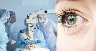 Preventing and Treating Cataracts: What You Need to Know