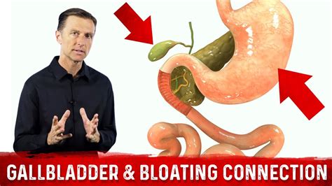 Understanding the Connection Between Bloating and Digestive Health