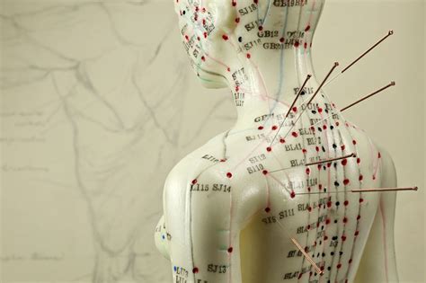 The Benefits of Acupuncture and Traditional Chinese Medicine