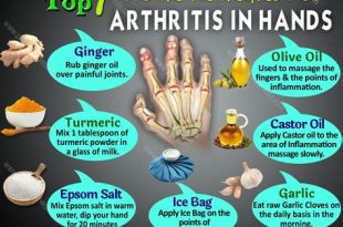 How to Prevent and Treat Arthritis