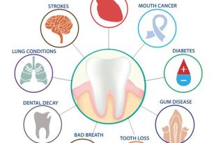 The Importance of Dental Care and Oral Hygiene