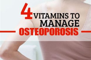 How to Prevent and Treat Osteoporosis